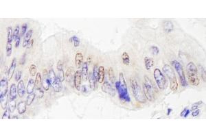 Immunohistochemistry (IHC) image for anti-Lysine (K)-Specific Demethylase 4A (KDM4A) (AA 350-400) antibody (ABIN7454377)