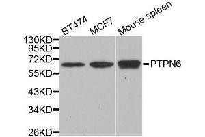 Western blot analysis of extracts of various cell lines, using PTPN6 antibody. (SHP1 Antikörper  (AA 100-400))