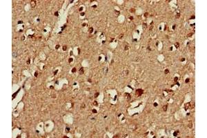 Immunohistochemistry of paraffin-embedded human brain tissue using ABIN7147395 at dilution of 1:100 (C3orf34 Antikörper  (AA 1-163))