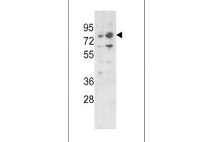 Western Blotting (WB) image for anti-Zinc Finger and BTB Domain Containing 16 (ZBTB16) (AA 637-666), (C-Term) antibody (ABIN390611)