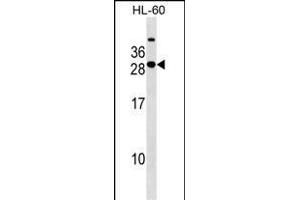 STXBP6 Antibody (Center) (ABIN1538584 and ABIN2849443) western blot analysis in HL-60 cell line lysates (35 μg/lane). (STXBP6 Antikörper  (AA 71-97))