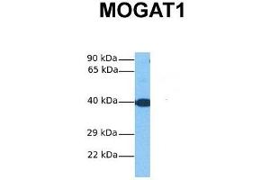 Host:  Rabbit  Target Name:  MOGAT1  Sample Tissue:  Human Fetal Liver  Antibody Dilution:  1. (MOGAT1 Antikörper  (C-Term))
