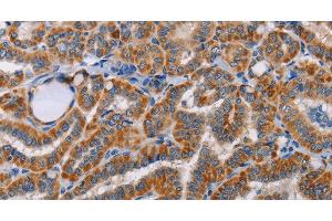 Immunohistochemistry of paraffin-embedded Human brain tissue using ALG9 Polyclonal Antibody at dilution 1:60 (ALG9 Antikörper)