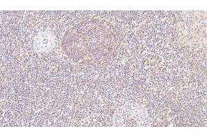 Detection of MMP7 in Human Spleen Tissue using Monoclonal Antibody to Matrix Metalloproteinase 7 (MMP7) (MMP7 Antikörper  (AA 18-267))