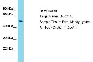 Host: Rabbit Target Name: LRRC14B Sample Type: Fetal Kidney lysates Antibody Dilution: 1. (LRRC14B Antikörper  (C-Term))