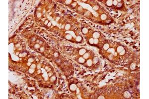Immunohistochemistry (IHC) image for anti-Bone Morphogenetic Protein 4 (BMP4) (AA 303-408) antibody (ABIN7145692)