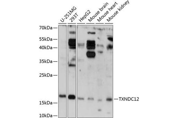 TXNDC12 抗体  (AA 93-172)