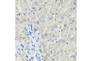 Immunohistochemistry of paraffin-embedded human liver using SLC19A1 antibody (ABIN6291462) at dilution of 1:100 (40x lens). (SLC19A1 Antikörper)