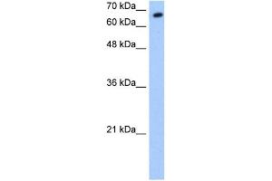 WB Suggested Anti-SYVN1 Antibody Titration:  0. (SYVN1 Antikörper  (C-Term))