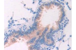 Immunohistochemistry (IHC) image for anti-Interleukin 1 Receptor, Type I (IL1R1) (AA 119-217) antibody (ABIN7430741)