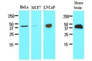 Western Blotting (WB) image for anti-Triggering Receptor Expressed On Myeloid Cells 2 (TREM2) (AA 19-161) antibody (ABIN336080) (TREM2 Antikörper  (AA 19-161))