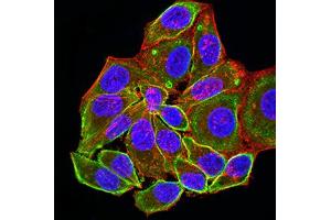 Immunofluorescence analysis of Hela cells using ALDOA mouse mAb (green). (ALDOA Antikörper  (AA 9-145))