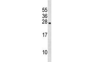 Western Blotting (WB) image for anti-Prolactin (PRL) (AA 48-76) antibody (ABIN3028948)