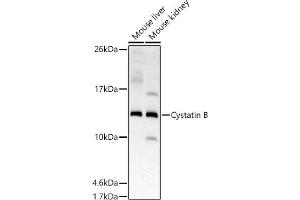 Western blot analysis of extracts of various cell lines, using Cystatin B antibody (ABIN7266617) at 1:500 dilution. (CSTB Antikörper)