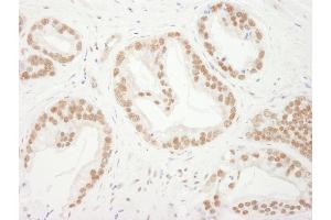 Immunohistochemistry (IHC) image for anti-Budding Uninhibited By Benzimidazoles 3 Homolog (Yeast) (BUB3) (AA 275-325) antibody (ABIN7449397) (BUB3 Antikörper  (AA 275-325))