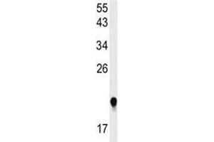 Western blot analysis of IMP3 antibody and HeLa lysate.