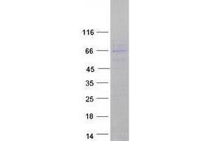 CNOT6L Protein (Myc-DYKDDDDK Tag)