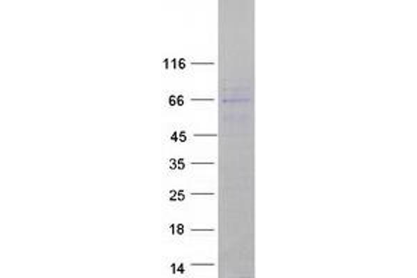 CNOT6L Protein (Myc-DYKDDDDK Tag)