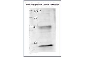Image no. 2 for anti-Acetylated Lysine (acetylated) antibody (ABIN264880) (Acetylated Lysine Antikörper  (acetylated))