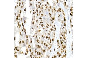 Immunohistochemistry of paraffin-embedded rat lung using XRCC2 Rabbit pAb  at dilution of 1:50 (40x lens). (XRCC2 Antikörper)
