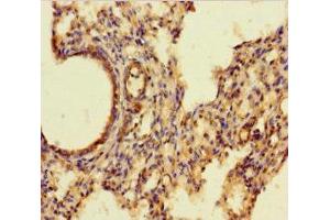 Immunohistochemistry of paraffin-embedded human lung tissue using ABIN7143728 at dilution of 1:100 (Iba1 Antikörper  (AA 2-147))