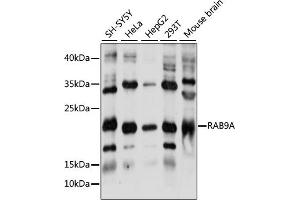 Western blot analysis of extracts of various cell lines, using RA antibody (ABIN7269818) at 1:1000 dilution. (RAB9A Antikörper  (AA 1-201))