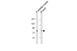 Western Blotting (WB) image for anti-Leo1, Paf1/RNA Polymerase II Complex Component, Homolog (S. Cerevisiae) (LEO1) (AA 130-159), (N-Term) antibody (ABIN388697)