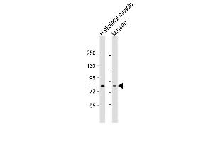 Western blot analysis of anti-Leo1 Antibody (N-term) (ABIN388697 and ABIN2838783) in HL60 cell line lysates (35 μg/lane). (LEO1 Antikörper  (N-Term))