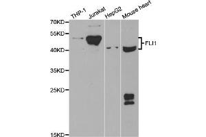 Western blot analysis of extracts of various cell lines, using FLI1 antibody (ABIN5973290) at 1/1000 dilution. (FLI1 Antikörper)