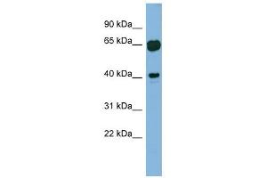 RAB3IL1 antibody used at 1 ug/ml to detect target protein. (RAB3IL1 Antikörper)