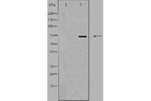 Western blot analysis of extracts from K562 cells, using SLC44A1 antibody.