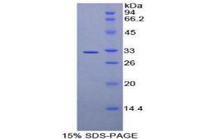 SDS-PAGE analysis of Human AMY2 Protein. (AMY2 Protein)