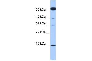 DYNLL2 antibody used at 1 ug/ml to detect target protein. (DYNLL2 Antikörper  (N-Term))