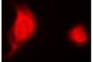 Immunofluorescent analysis of ESE-1 staining in A549 cells. (ELF3 Antikörper)