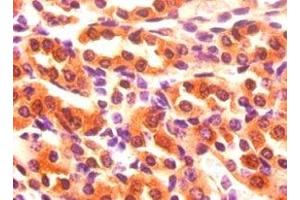 Immunohistochemistry (IHC) image for anti-Fatty Acid Binding Protein 3, Muscle and Heart (FABP3) (AA 2-133) antibody (ABIN7152629)