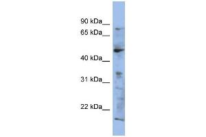 WB Suggested Anti-RAB3IP Antibody Titration: 0. (RAB3IP Antikörper  (N-Term))