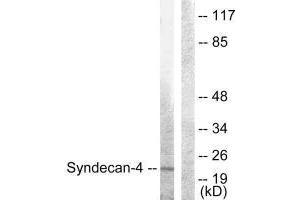 Western blot analysis of extracts from HepG2 cells, using Syndecan4 (Ab-179) antibody. (SDC4 Antikörper  (Ser179))