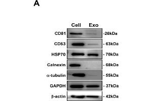 HCM-derived exosomes are transported into human cardiac fibroblasts (HCF) in vitro.