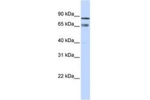 Image no. 1 for anti-IKAROS Family Zinc Finger 1 (Ikaros) (IKZF1) (AA 252-301) antibody (ABIN6742212) (IKZF1 Antikörper  (AA 252-301))