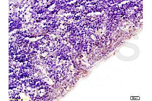 Formalin-fixed and paraffin embedded rat spleen tissue labeled with Anti-Acetyl-Histone H1b(K53) Polyclonal Antibody (ABIN729973), Unconjugated at 1:200, followed by conjugation to the secondary antibody and DAB staining (Histone H1 Antikörper  (acLys52))