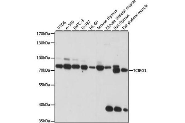 TCIRG1 Antikörper  (AA 1-130)