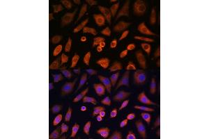 Immunofluorescence analysis of L-929 cells using N-WASP/WASL Polyclonal Antibody (ABIN3016273, ABIN3016274, ABIN3016275, ABIN1683282 and ABIN6219682) at dilution of 1:100 (40x lens). (Neural Wiskott-Aldrich syndrome protein (WASL) (AA 1-250) Antikörper)