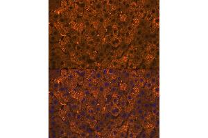 Immunofluorescence analysis of rat liver using SULT2 Rabbit mAb (ABIN7270632) at dilution of 1:100 (40x lens).