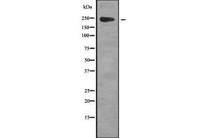 anti-Zinc Finger, C3H1-Type Containing (ZFC3H1) (Internal Region) antibody