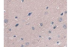 Immunohistochemistry (IHC) image for anti-Glutathione Peroxidase 3 (Plasma) (GPX3) (AA 3-72) antibody (ABIN7443332)