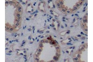 Detection of ErbB2 in Human Kidney Tissue using Monoclonal Antibody to Receptor Tyrosine Protein Kinase erbB-2 (ErbB2) (ErbB2/Her2 Antikörper  (AA 376-578))