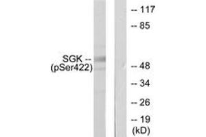 Western blot analysis of extracts from HeLa cells treated with Insulin 0. (SGK1 Antikörper  (pSer422))