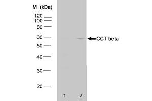 Western blot analysis of HeLa whole cell lysate (1) and HeLa heat stressed whole cell (CCT2 Antikörper)