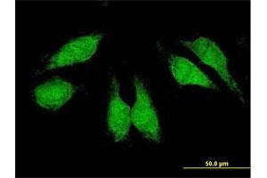 Immunofluorescence of purified MaxPab antibody to CRKL on HeLa cell. (CrkL Antikörper  (AA 1-303))