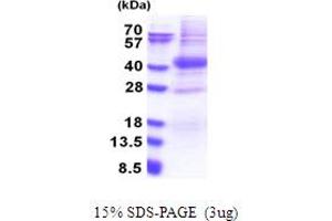 SDS-PAGE (SDS) image for Proto-Oncogene Pim-2 (Serine Threonine Kinase) (PIM2) (AA 1-311) protein (His tag) (ABIN5853728) (PIM2 Protein (AA 1-311) (His tag))